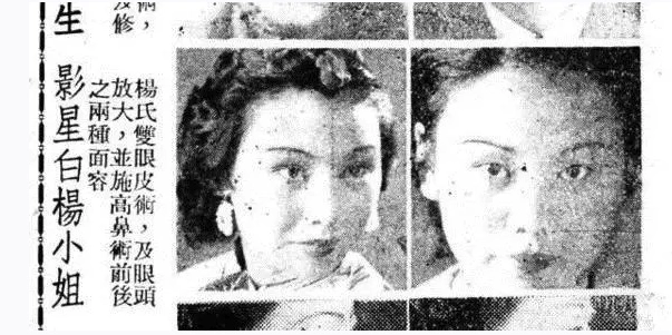 雀斑妆 欧阳娜娜雀斑妆 宋祖儿雀斑妆_国内雀斑多的女明星